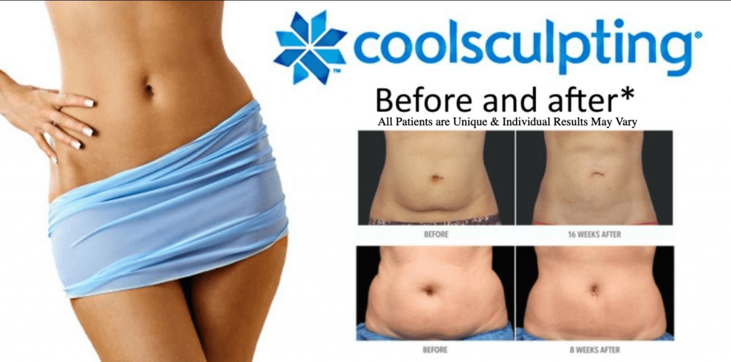Coolsculpting Specialty Doctor in Miami - Dr J Salmon