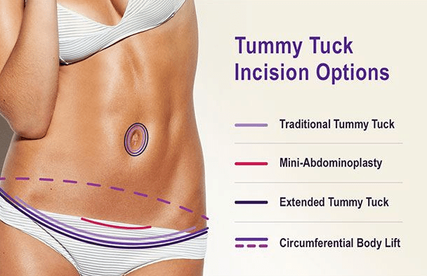 Will A Tummy Tuck Change ﻿My Clothing Size?
